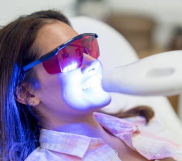 woman getting laser teeth whitening 1