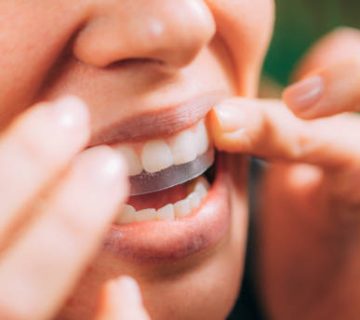 woman using whitening stipes or whitestrips whitening teeth at home