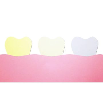 yellow to white tooth teeth whitening before and after