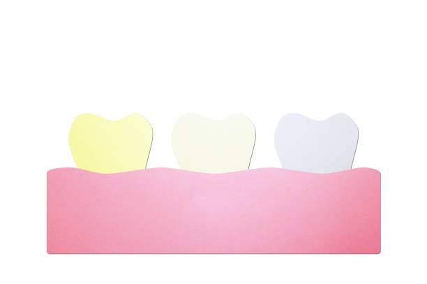 yellow to white tooth teeth whitening before and after