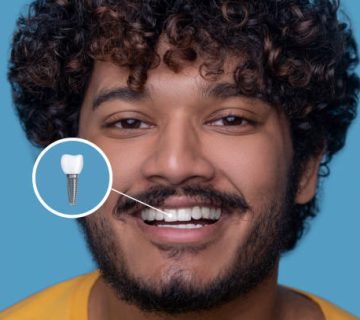 young man with a toothy smile demonstrating his dental implant