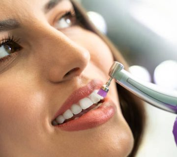 young woman getting her teeth polished 3