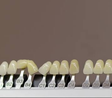 zirconium porcelain and implant studies in the dental laboratory