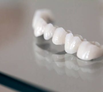 zirconium porcelain tooth plate in dentist store